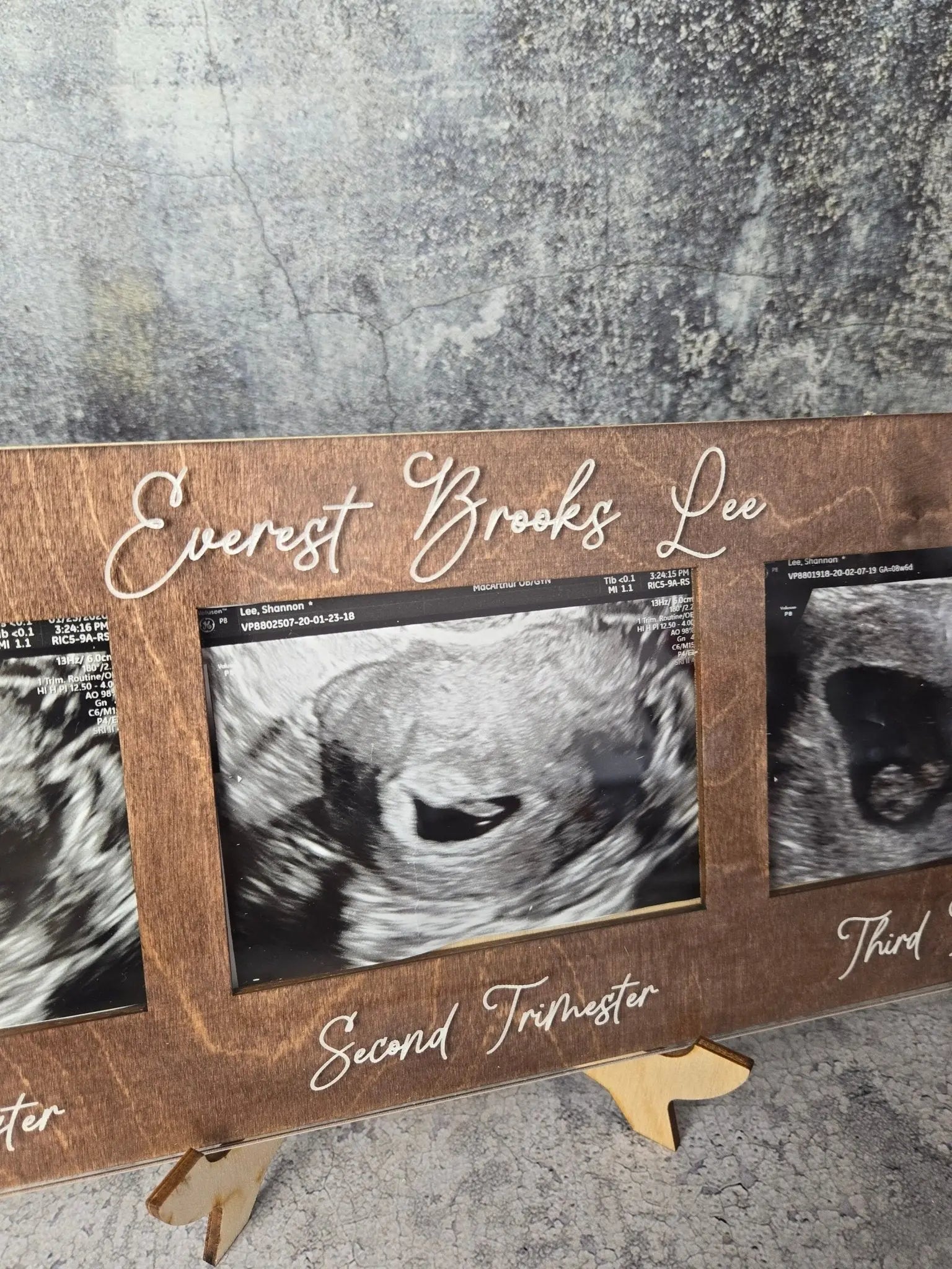 Ultrasound Picture Frame 1st-3rd Trimester EverLee Creations